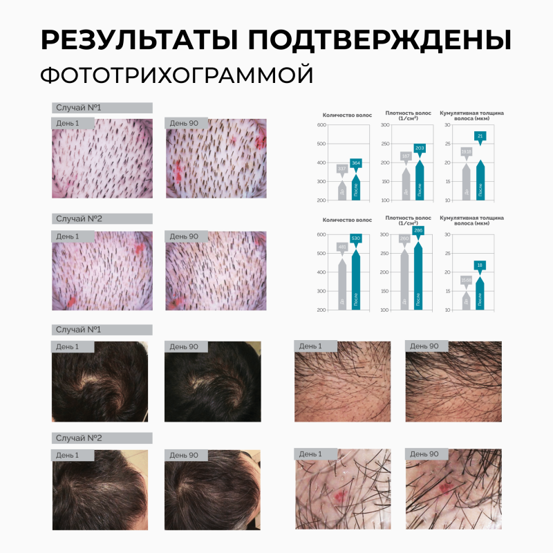 Кондиционер с пептидами для стимуляции роста волос Peptide Pro Line, 250 мл